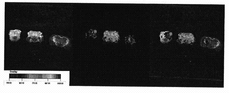 A brain-targeted drug delivery system