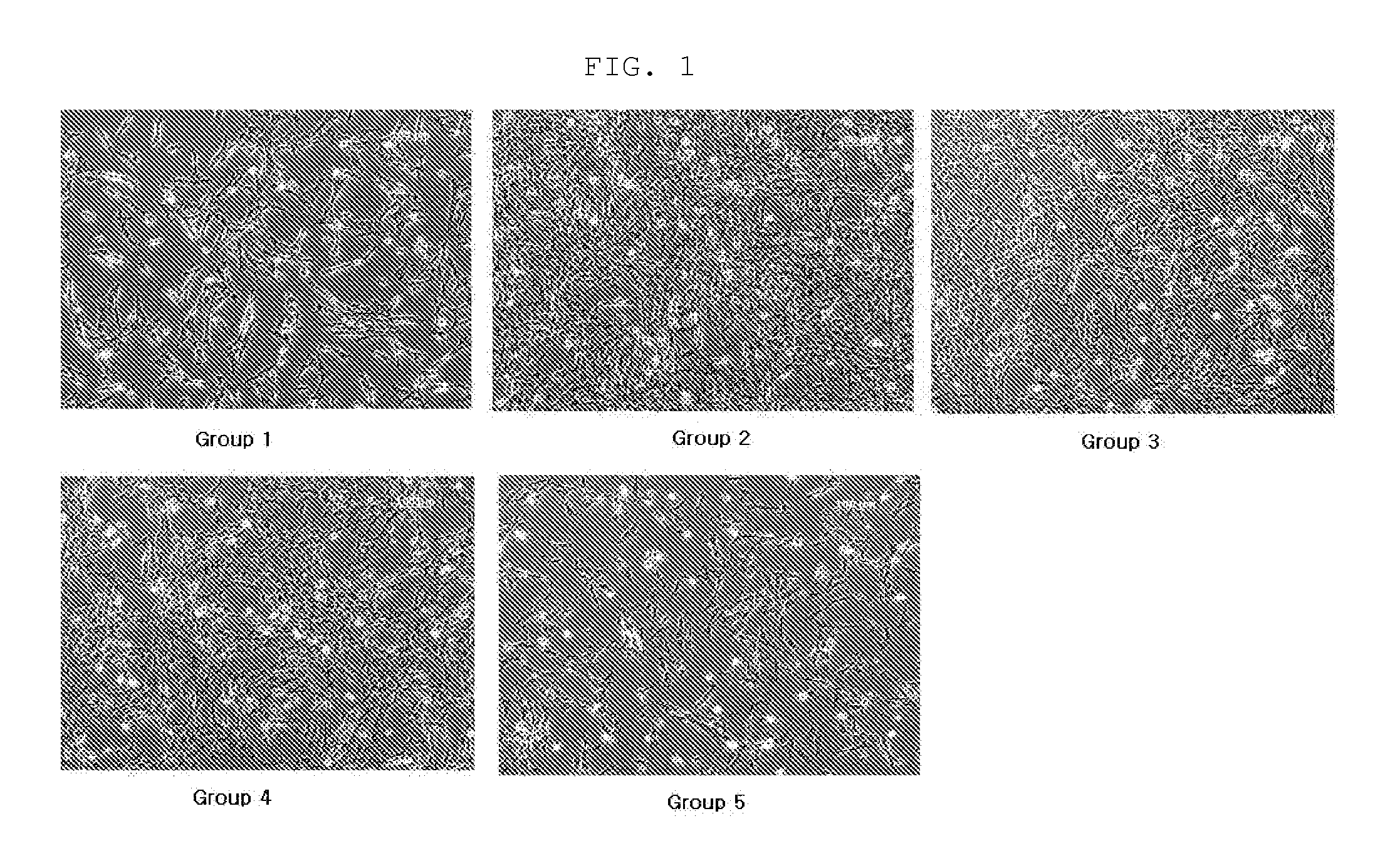 Culture medium composition for culturing amnion-derived mesenchymal stem cell, and method for culturing amnion-derived mesenchymal stem cell by using same