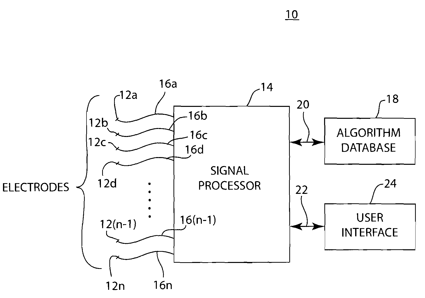 Method and apparatus with reduced electrode system specific ECG interpretation