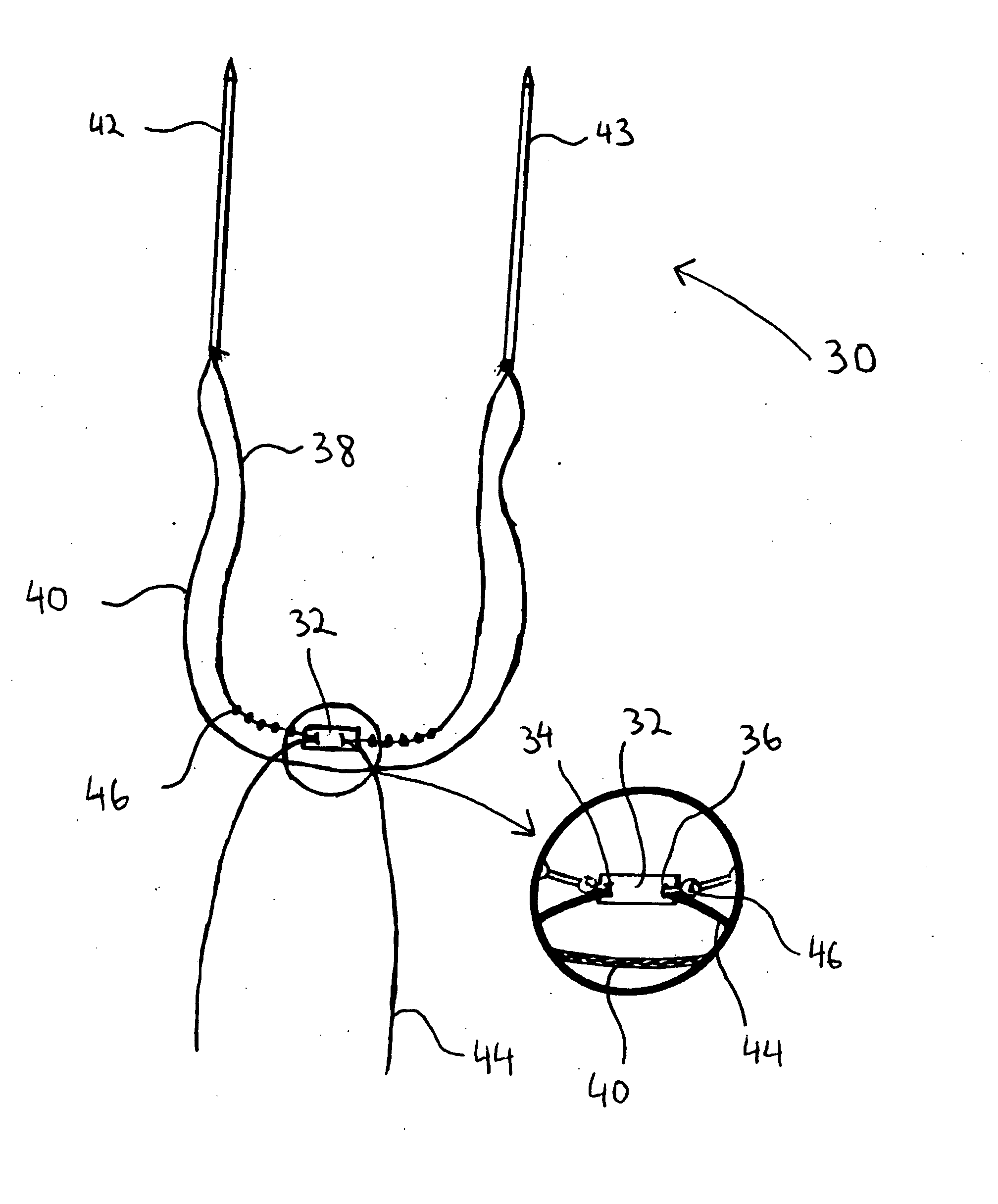 Suture and method using a suture