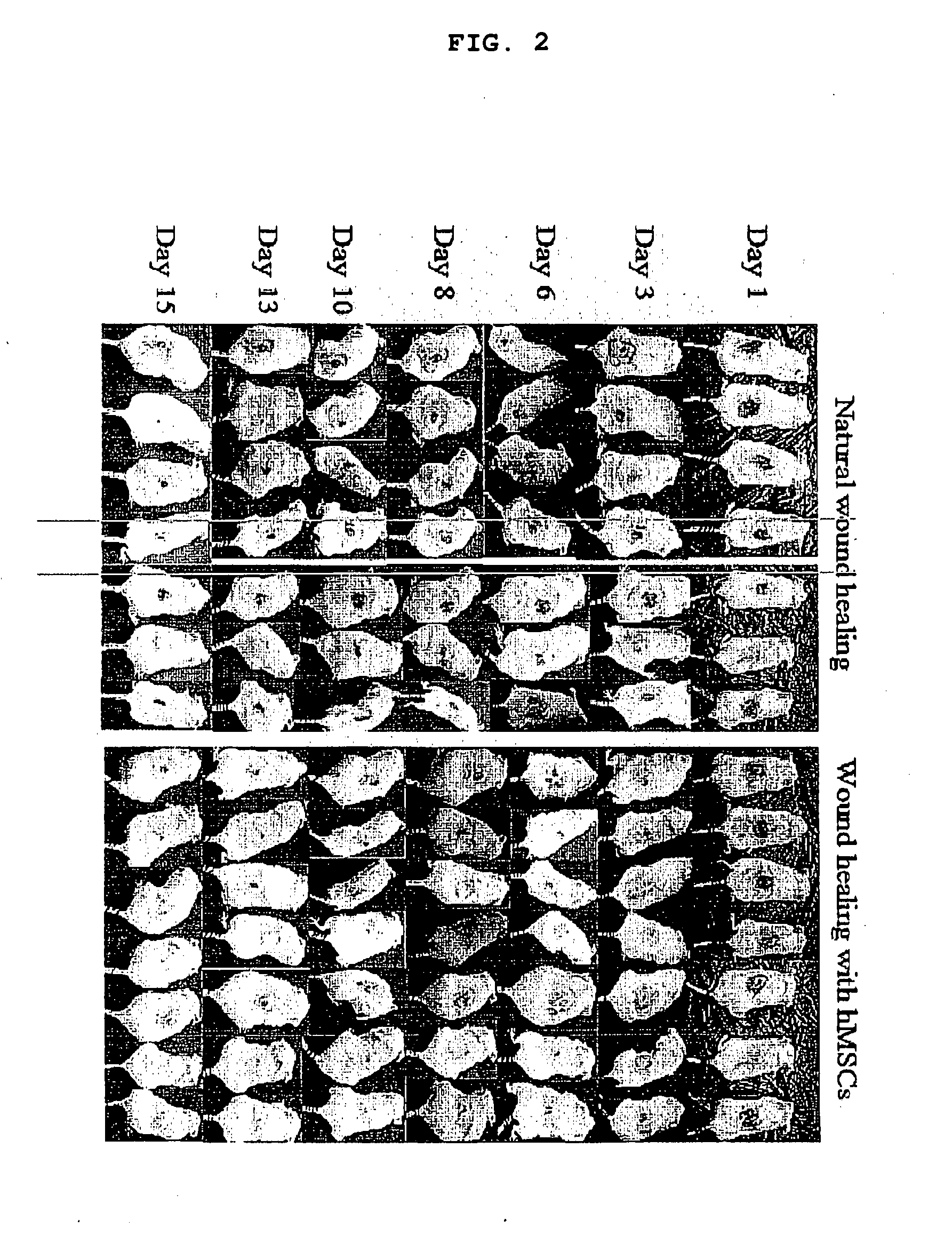 Use of stem cells for wound healing