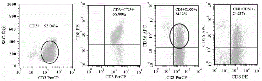 Chimeric antigen receptor, gene and recombinant expression vector thereof, CAR20-NKT cell and preparation method and application thereof