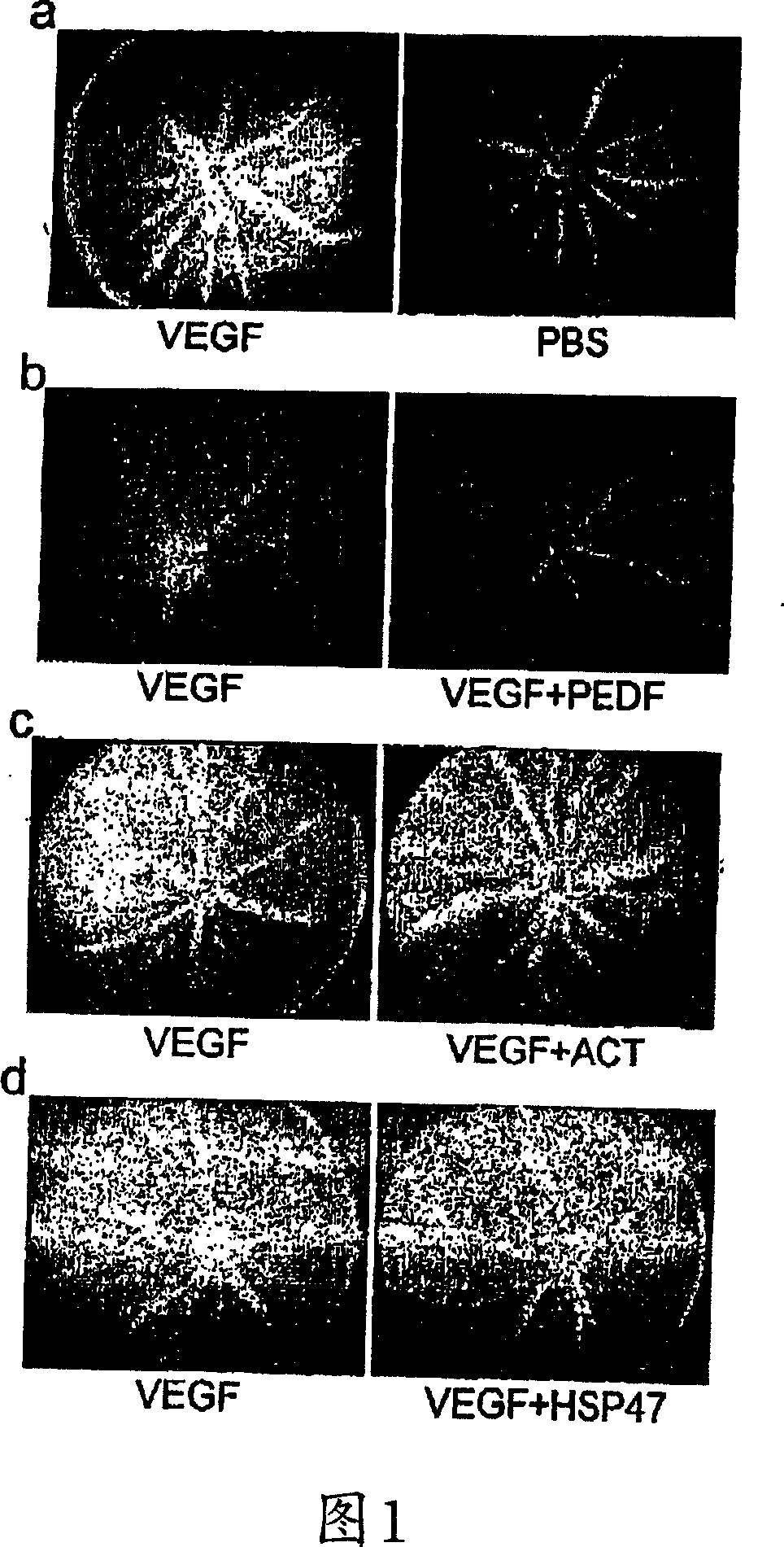 Biological activity of pigment epithelium-derived factor and methods of use