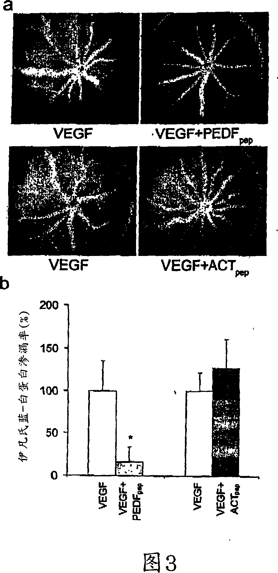 Biological activity of pigment epithelium-derived factor and methods of use