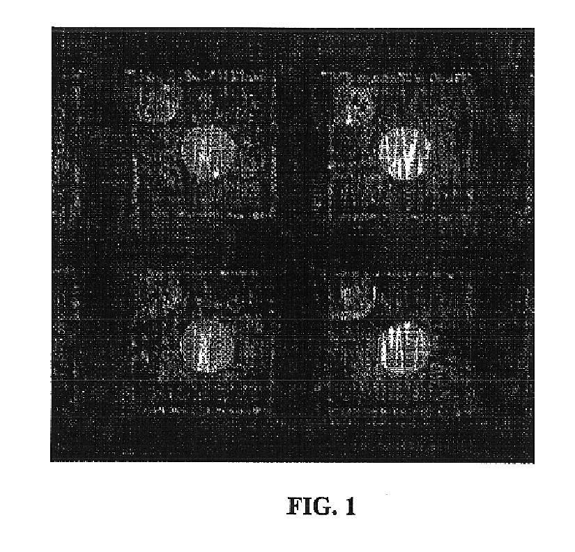 Semiconductor wafer protection and cleaning for device separation using laser ablation