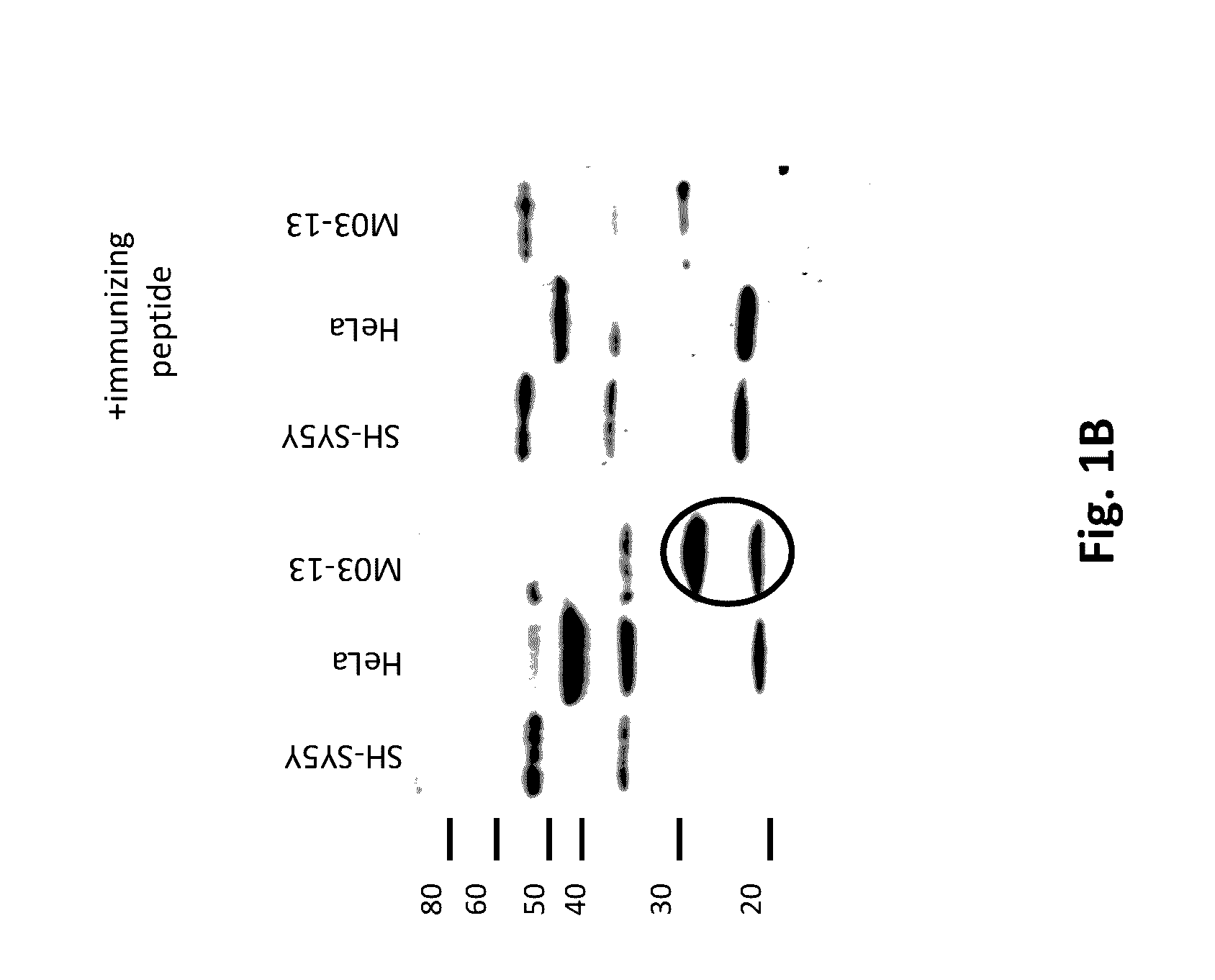 Diagnosis and therapy of Multiple Sclerosis