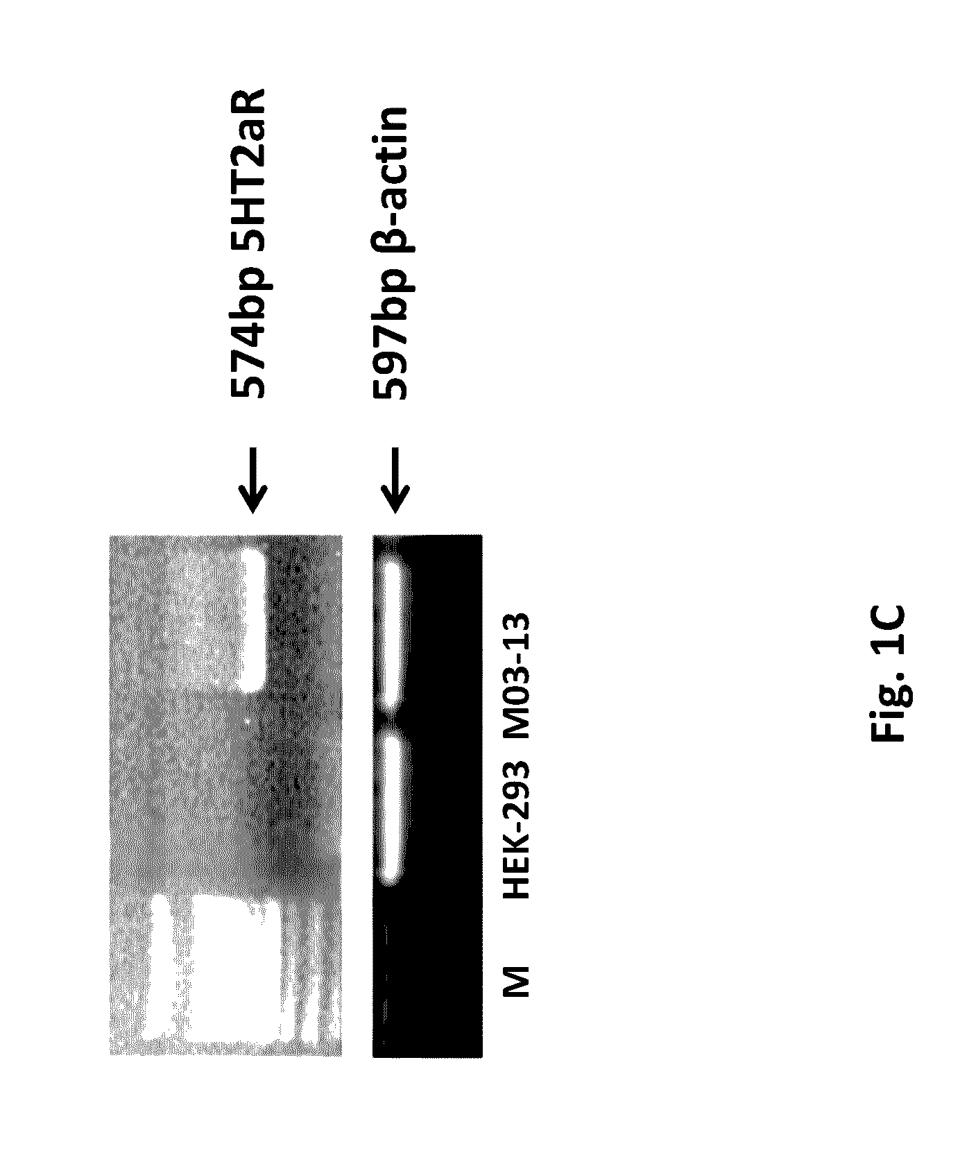 Diagnosis and therapy of Multiple Sclerosis