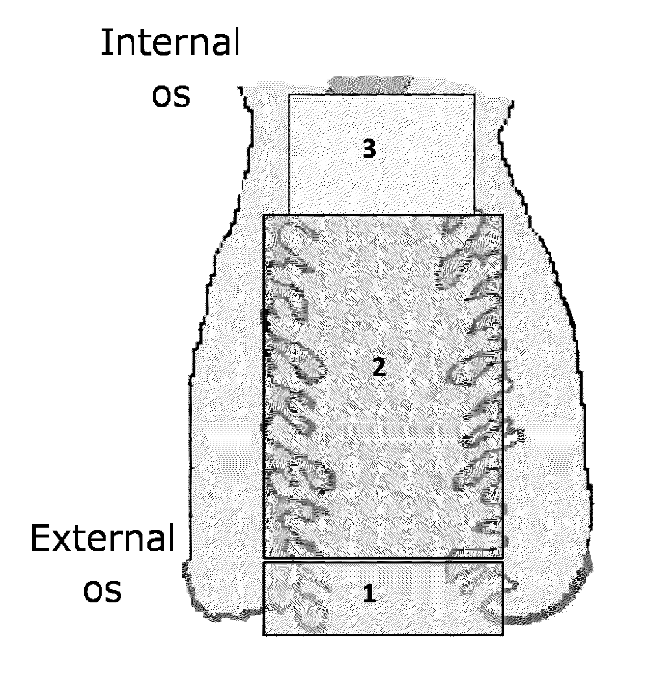 Methods of enriching and detecting fetal nucleic acids