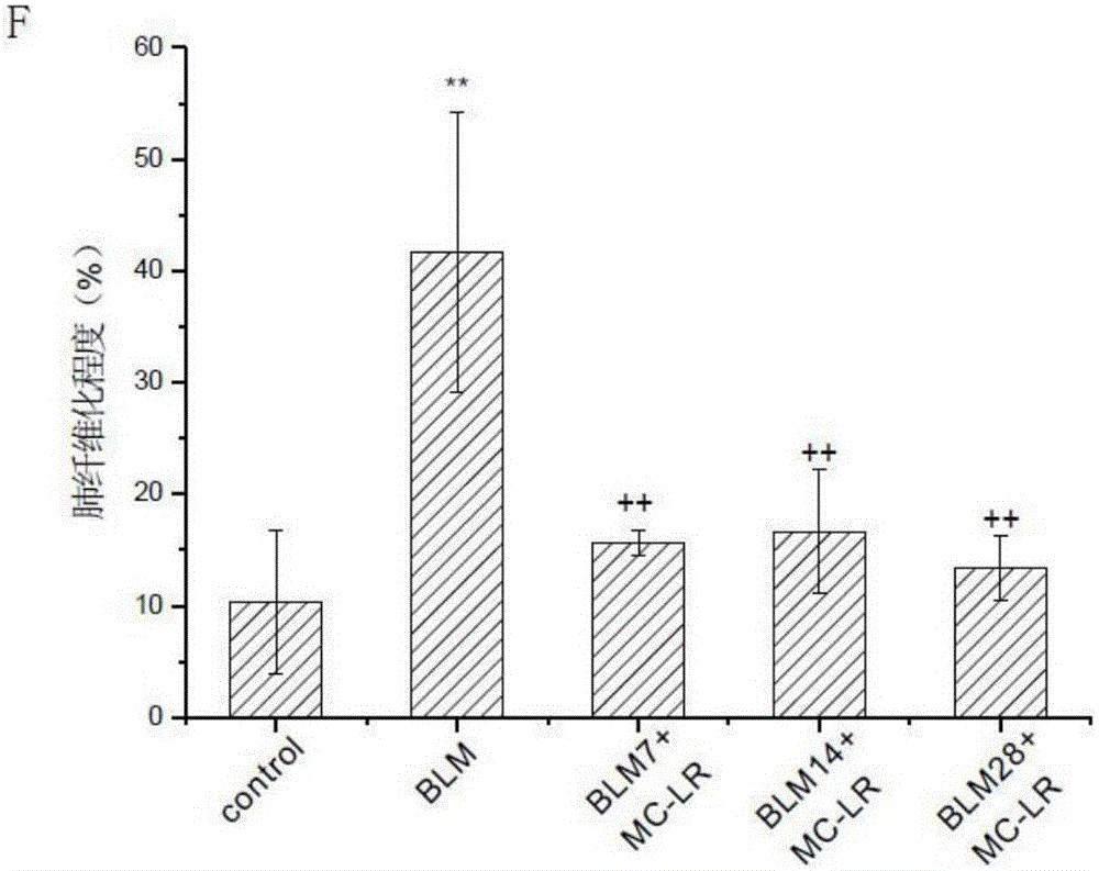 Application of microcystic toxins-LR in preparation of medicines for preventing and treating pulmonary fibrosis