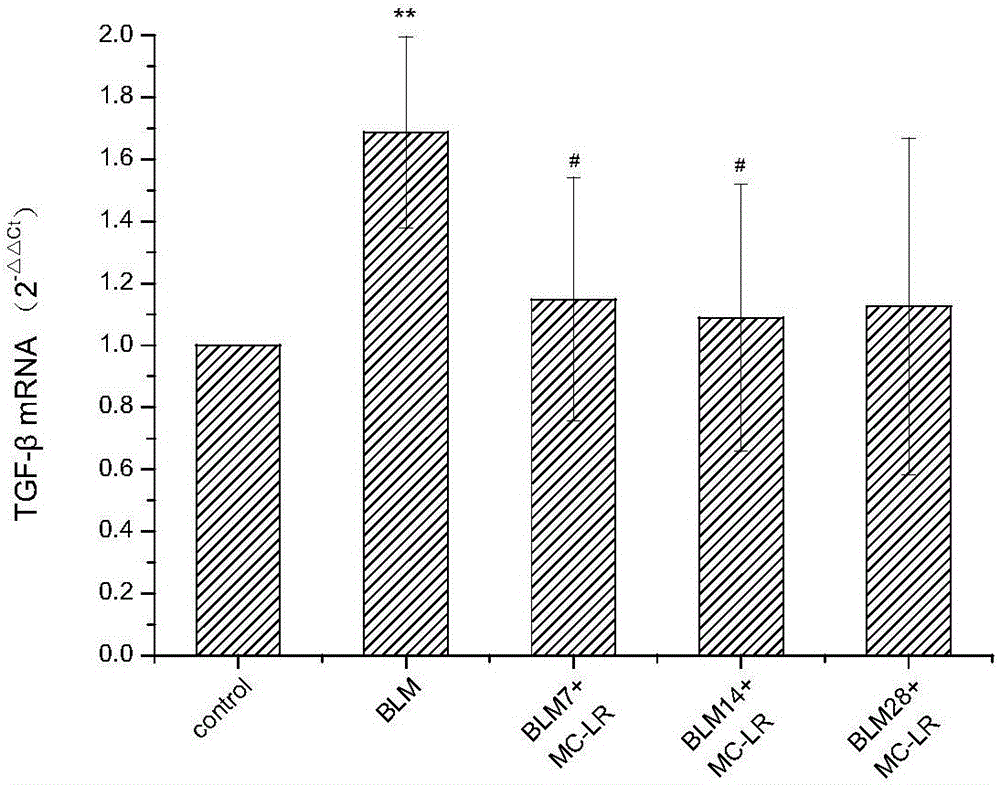 Application of microcystic toxins-LR in preparation of medicines for preventing and treating pulmonary fibrosis