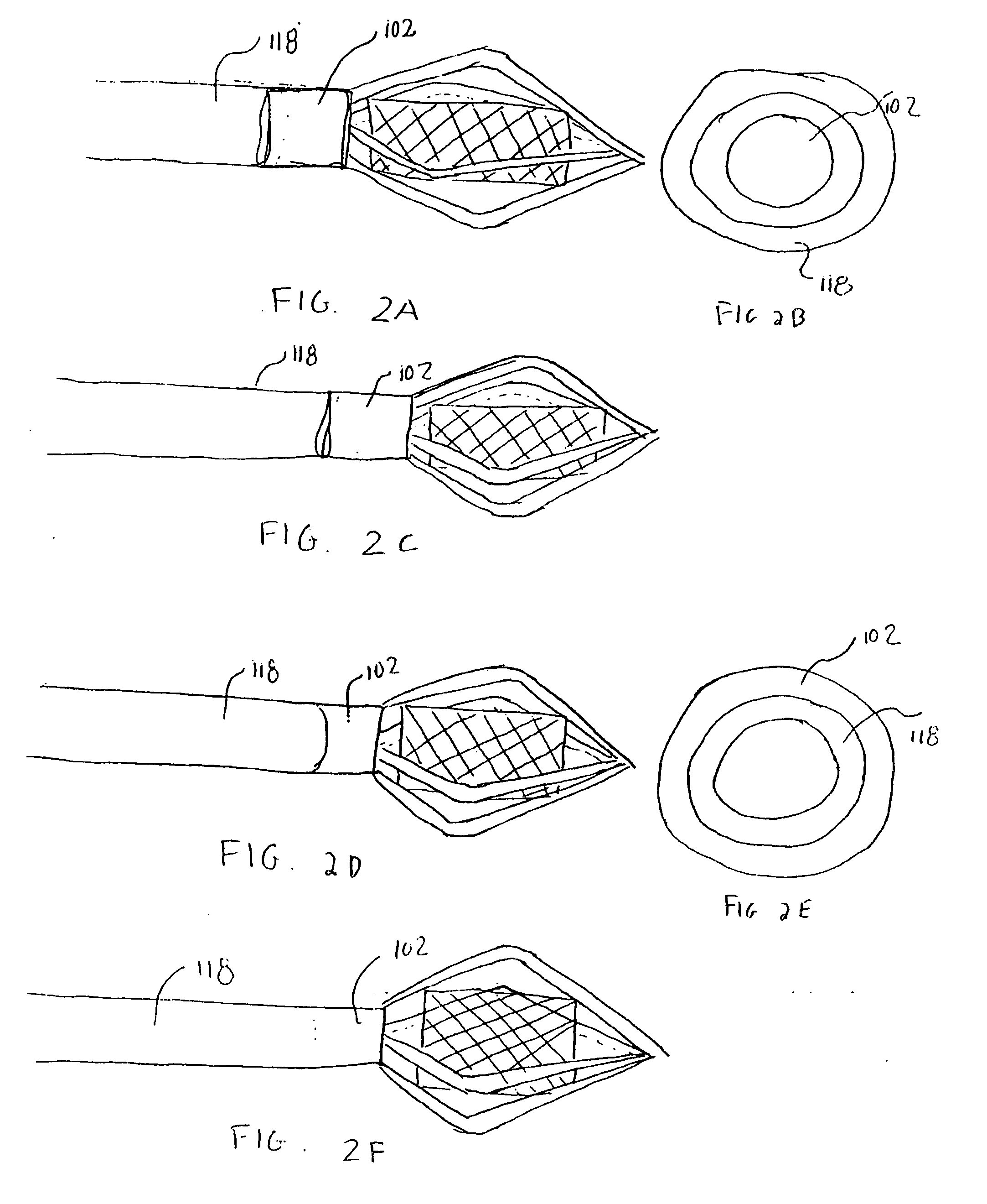 Method and apparatus for caged stent delivery