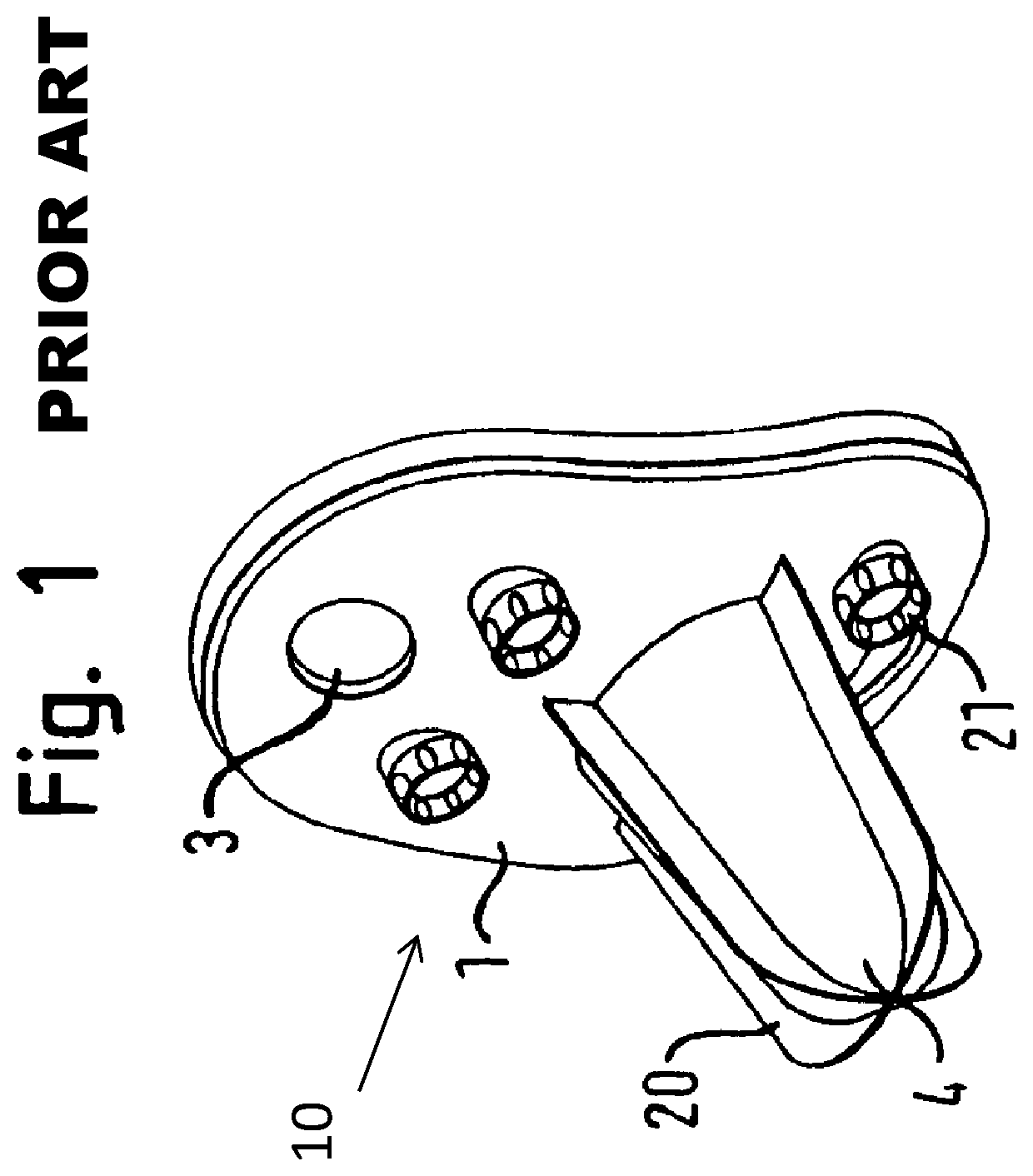 Glenoid anchor for a shoulder joint prosthesis