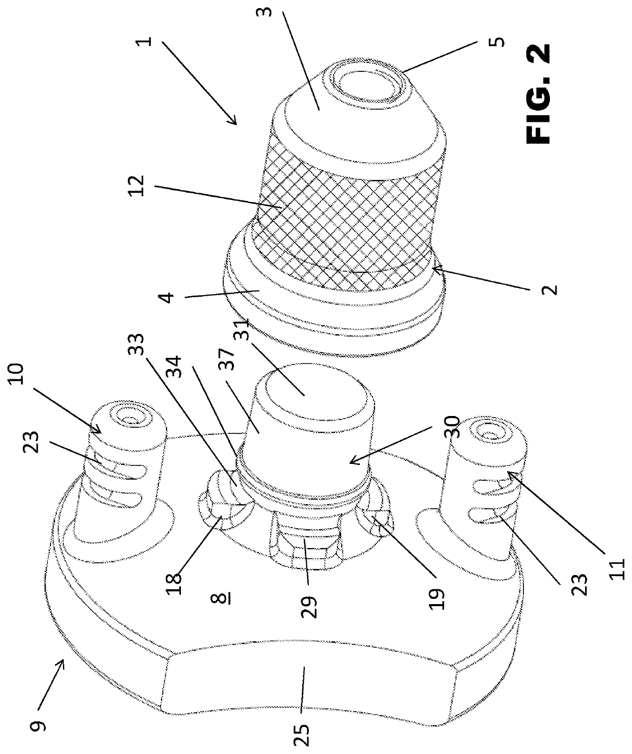 Glenoid anchor for a shoulder joint prosthesis