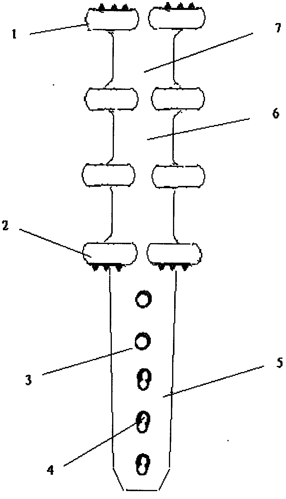 Internal fixation device for fracture around proximal femoral prosthesis