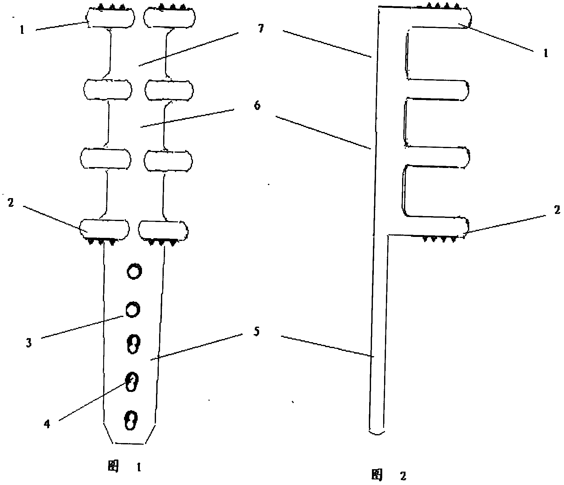 Internal fixation device for fracture around proximal femoral prosthesis