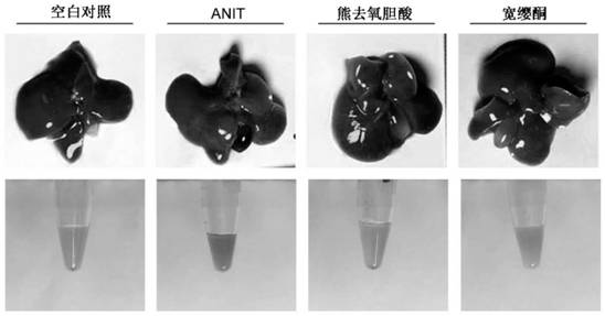 Application of quassin type diterpenoid compound in preparation of medicine for treating cholestatic liver disease