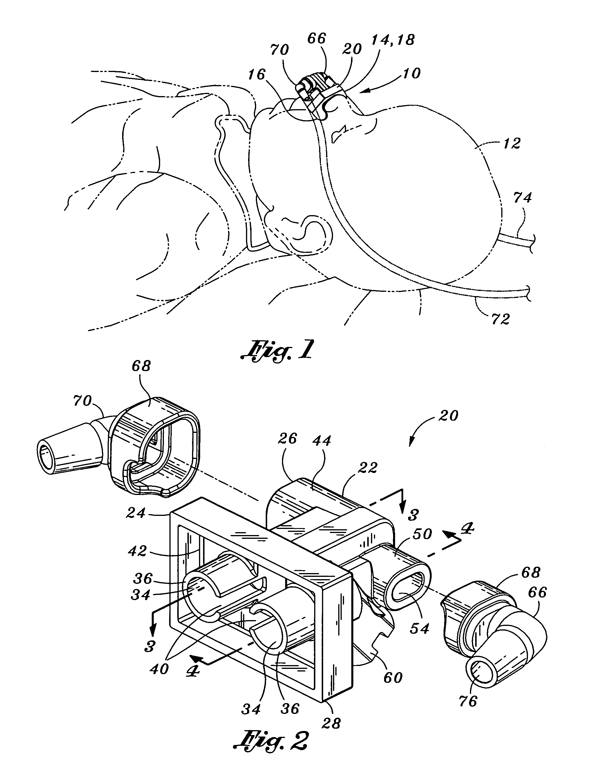 Venturi geometry design for flow-generator patient circuit