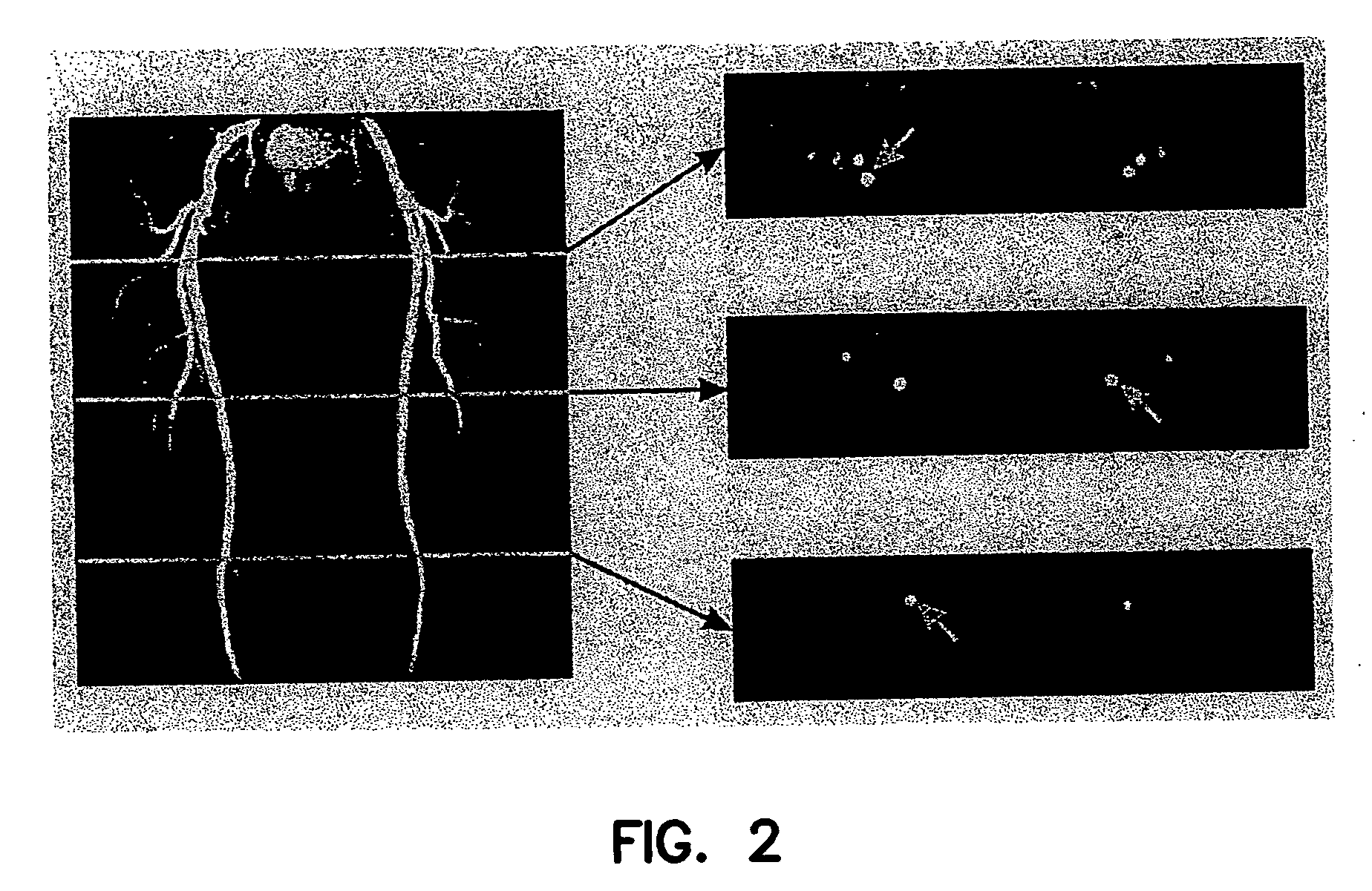 Method and apparatus for anatomically tailored k-space sampling and recessed elliptical view ordering for bolus-enhanced 3D MR angiography