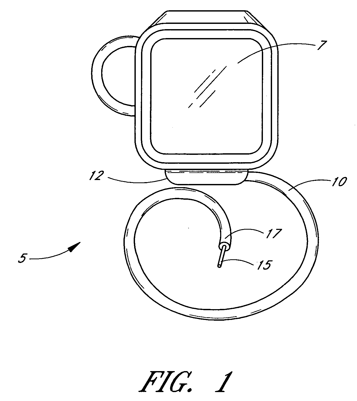 Method for detecting, diagnosing, and treating cardiovascular disease