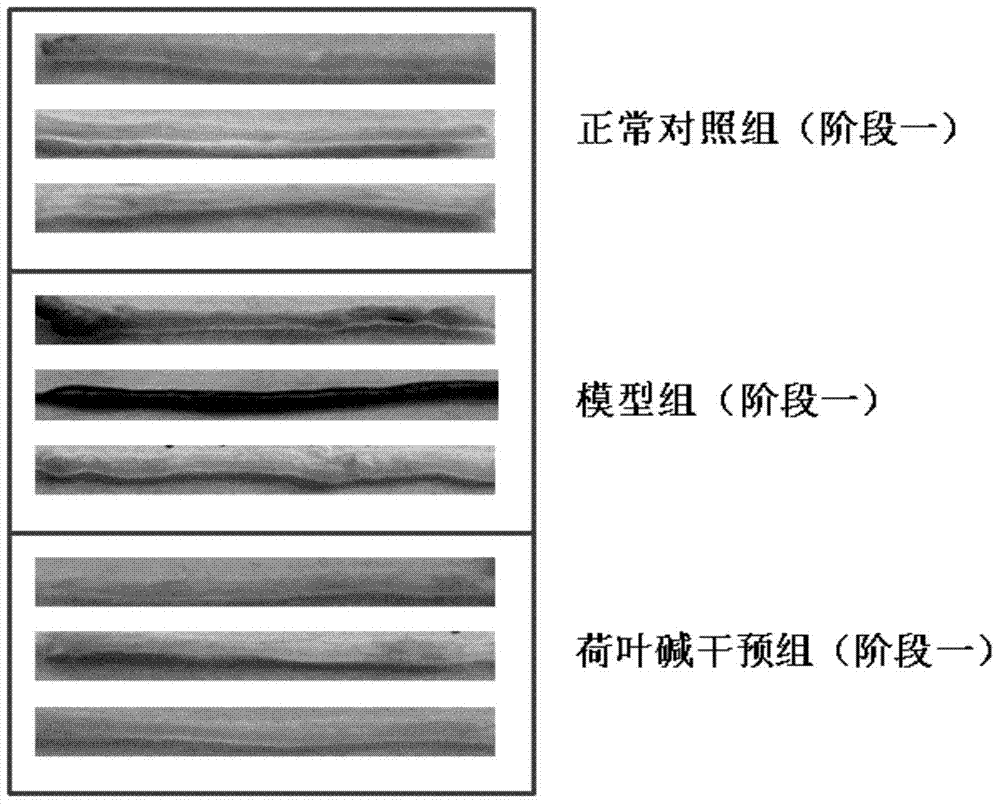 Use of alkaloid as inflammatory cancer translation blocking and tumor preventing medicine