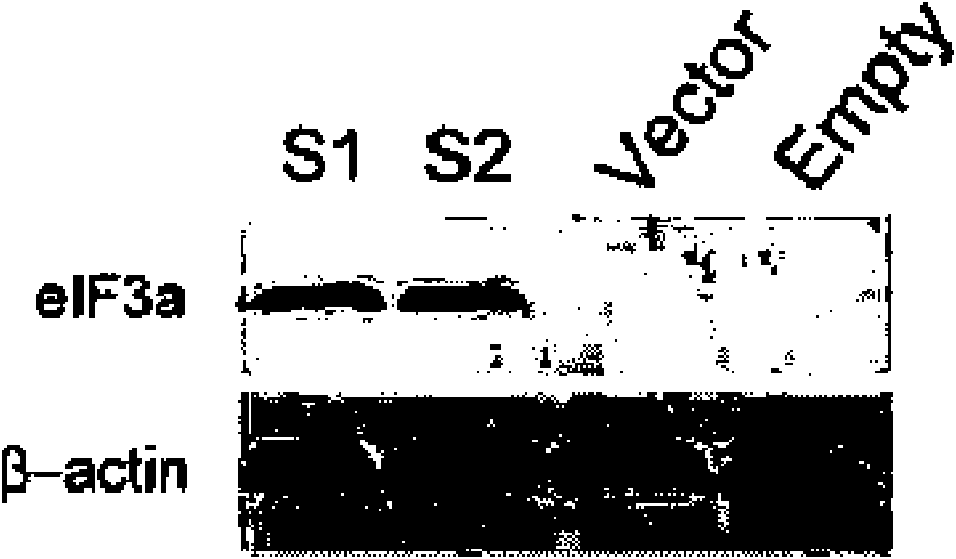 Cell line used for susceptibility detection of lung cancer chemotherapy drugs and establishment thereof