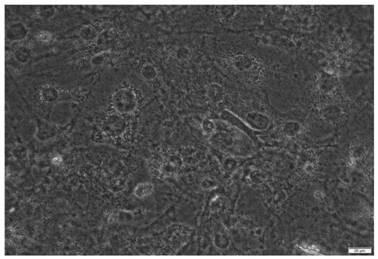 Application of streptococcus thermophilus MN002 in lipid metabolism regulation and dietary supplement