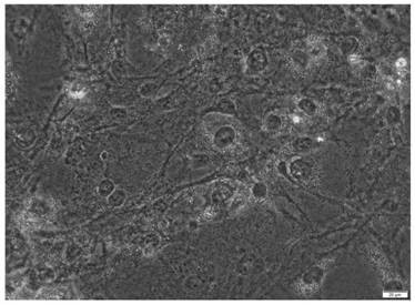 Application of streptococcus thermophilus MN002 in lipid metabolism regulation and dietary supplement