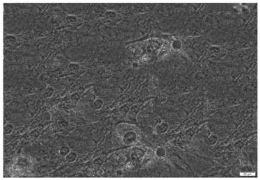 Application of streptococcus thermophilus MN002 in lipid metabolism regulation and dietary supplement