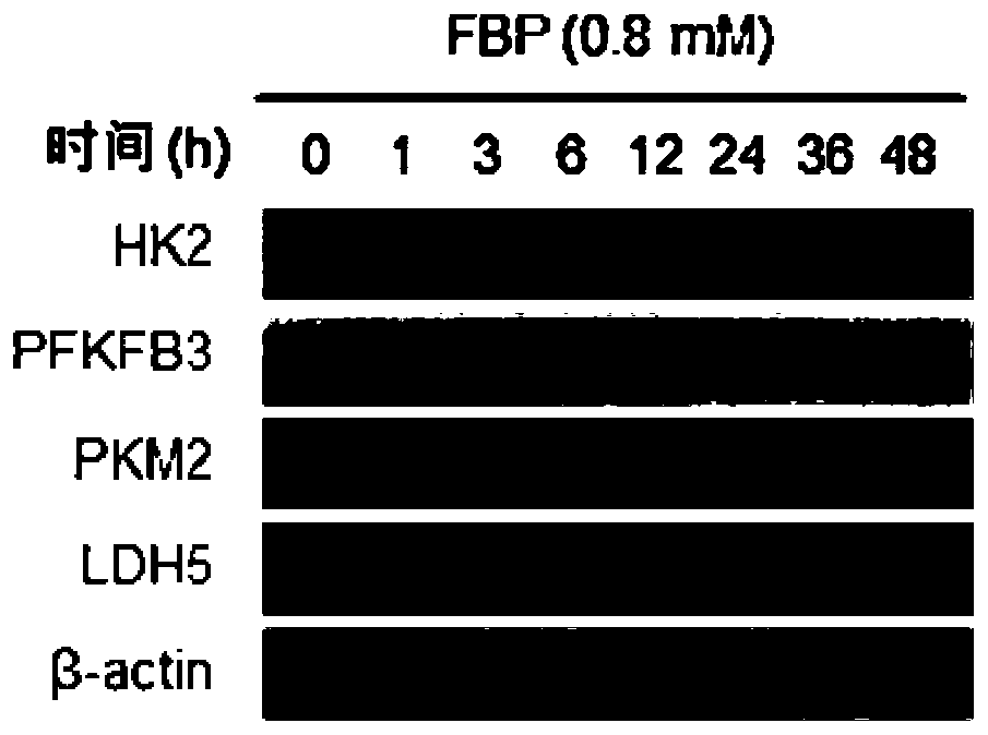 Medical use of fructose-1,6-bisphosphate and its blood drug concentration stabilizer composition