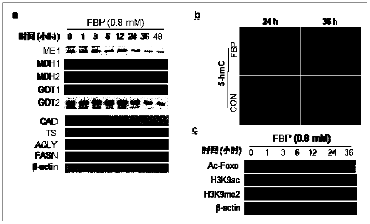 Medical use of fructose-1,6-bisphosphate and its blood drug concentration stabilizer composition