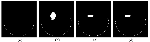 X-ray computed tomography (CT) metal artifact processing method