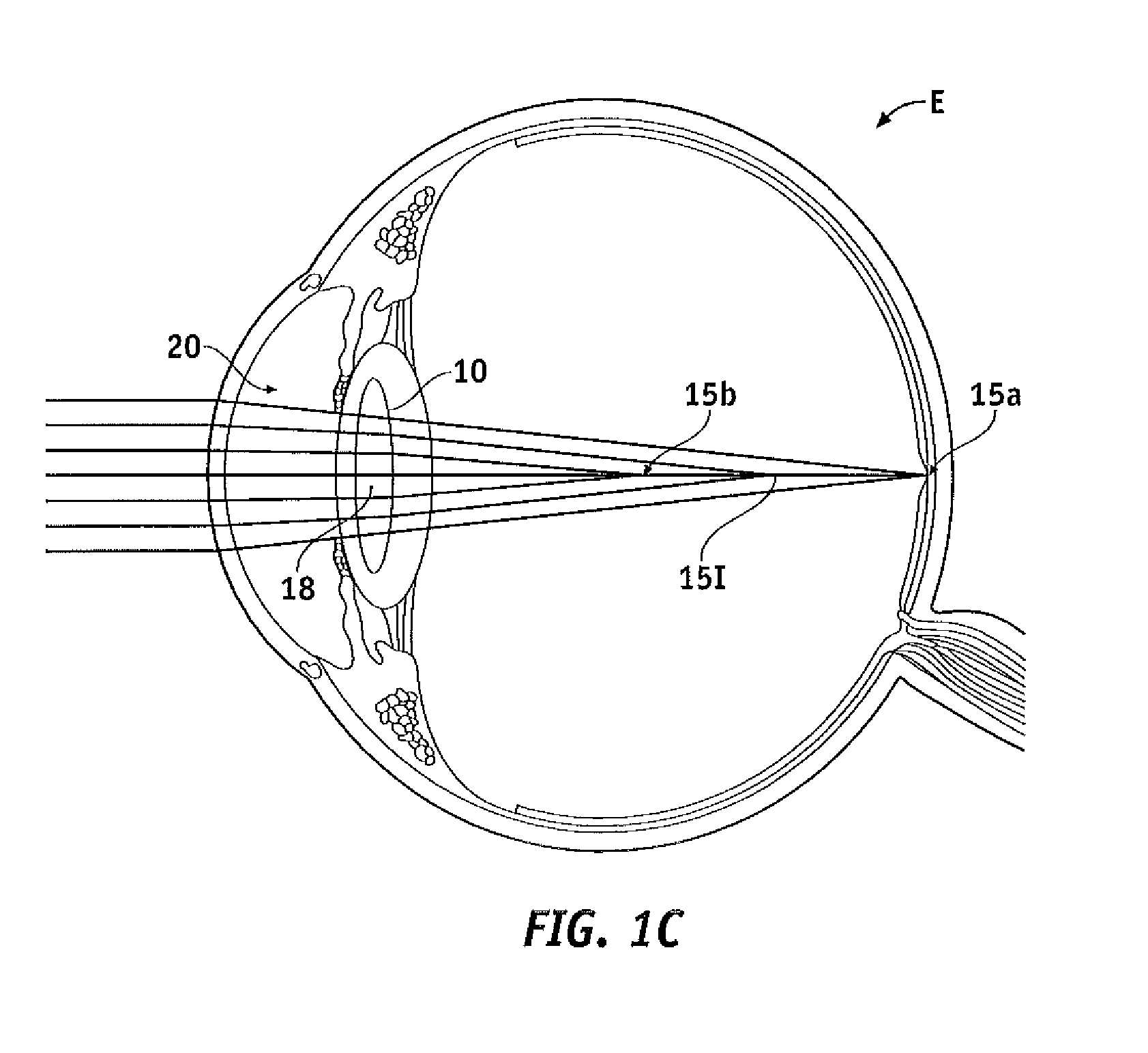 Pupil dependent diffractive lens for near, intermediate, and far vision