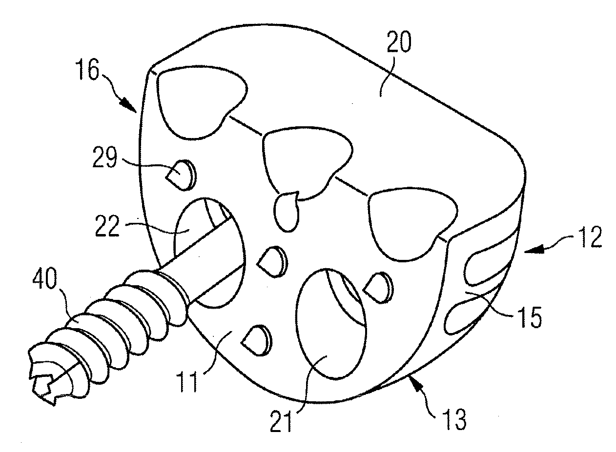 Glenoid extension block