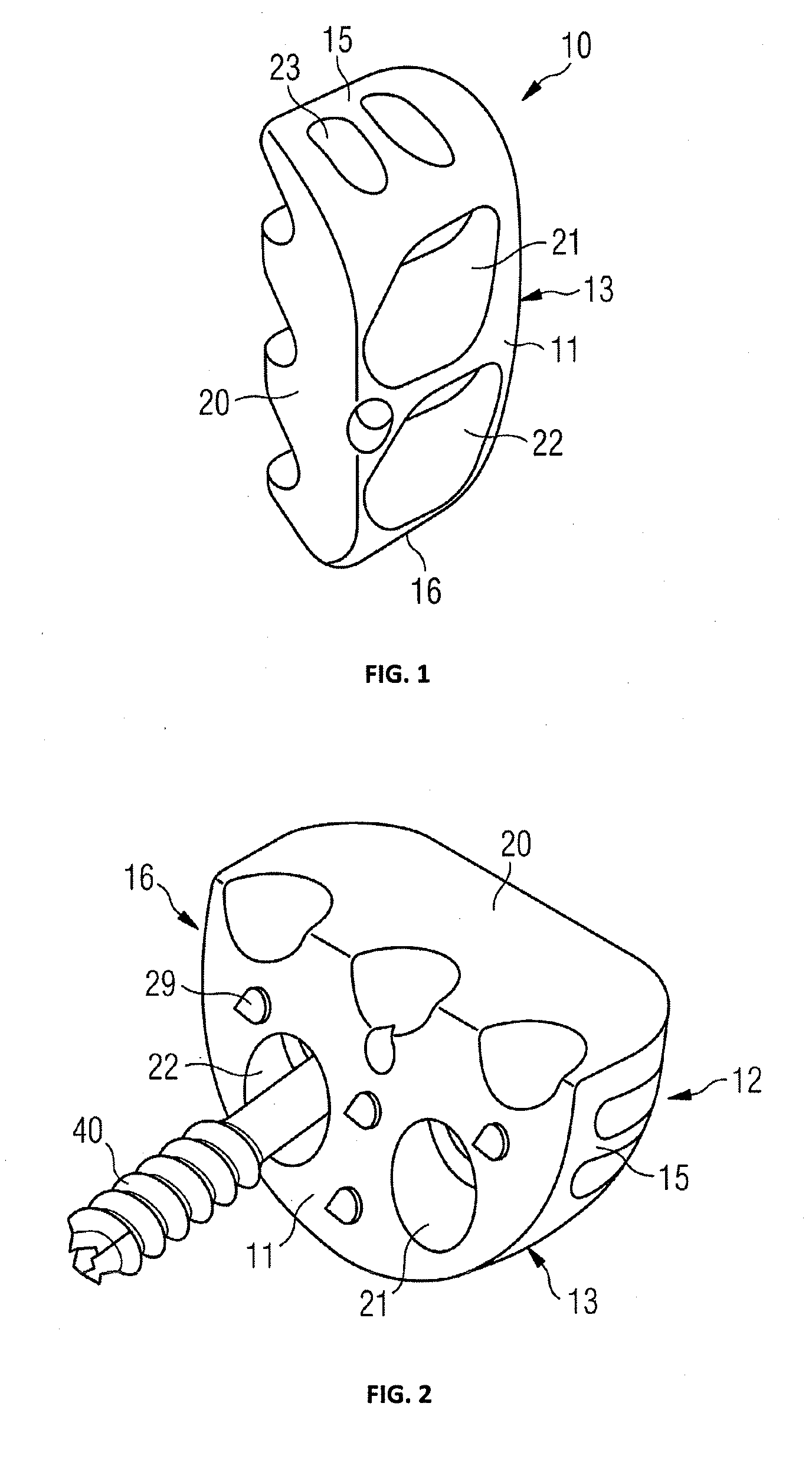 Glenoid extension block