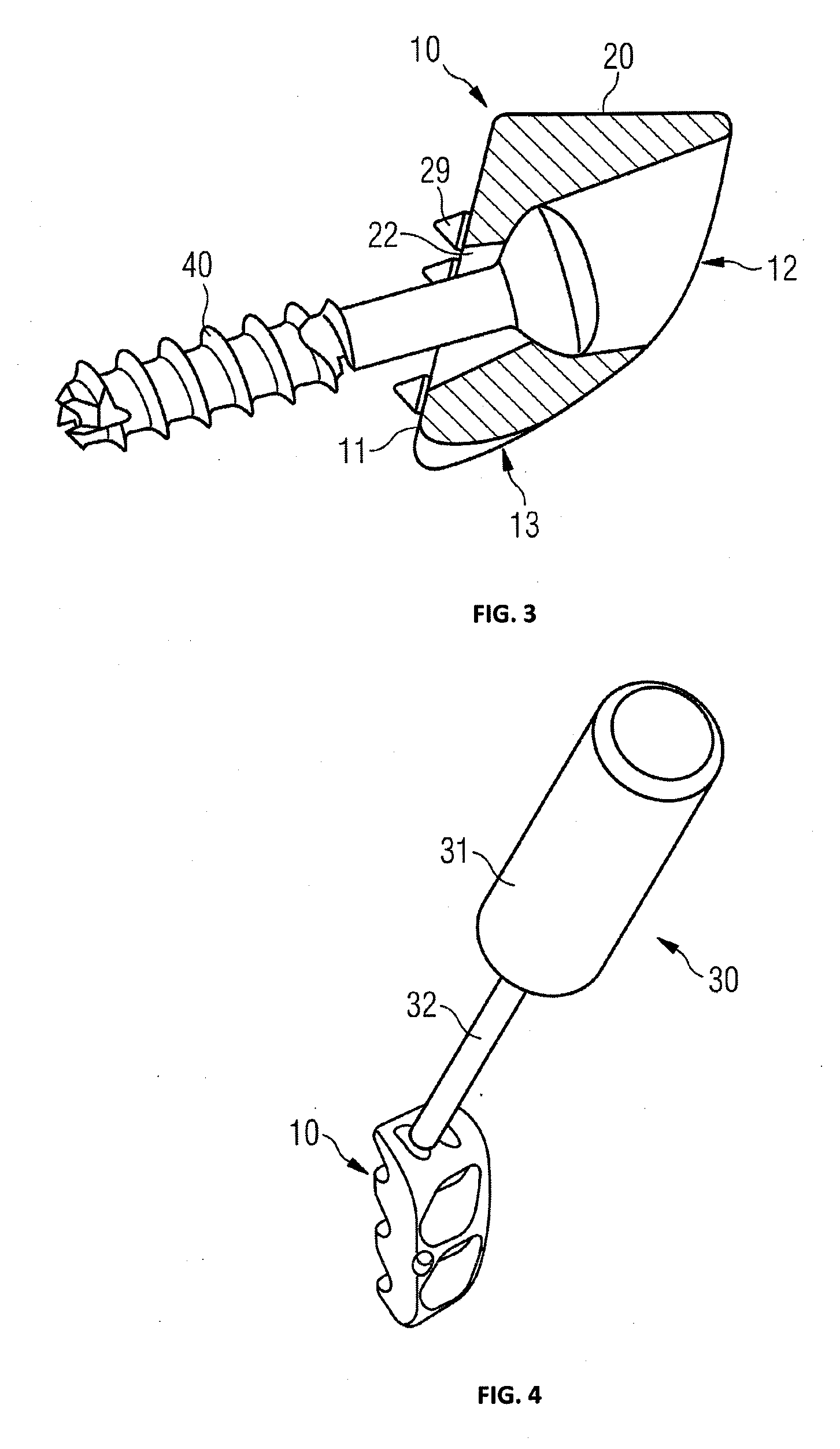 Glenoid extension block