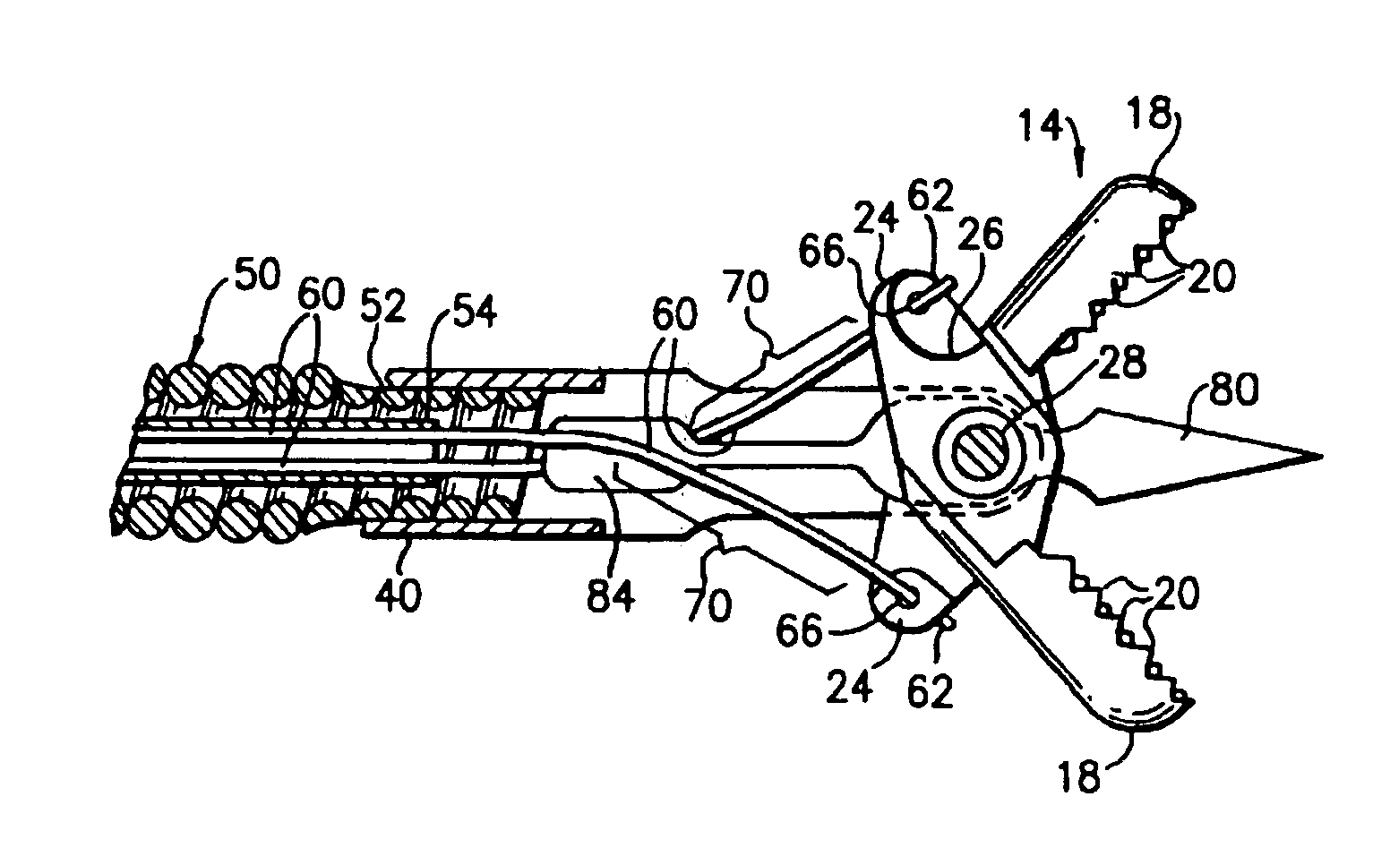 Radial jaw biopsy forceps