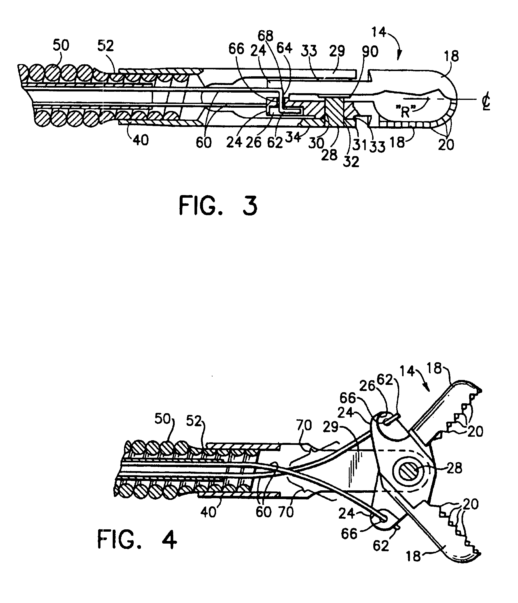 Radial jaw biopsy forceps