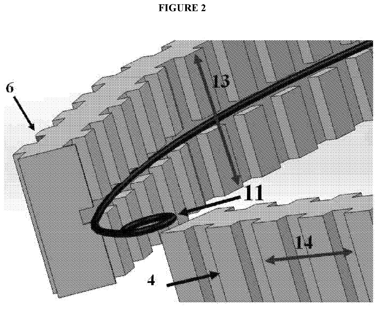 Devices and methods for stabilization of an ocular lens capsule and preventing artificial intraocular lens implant rotation post cataract surgery