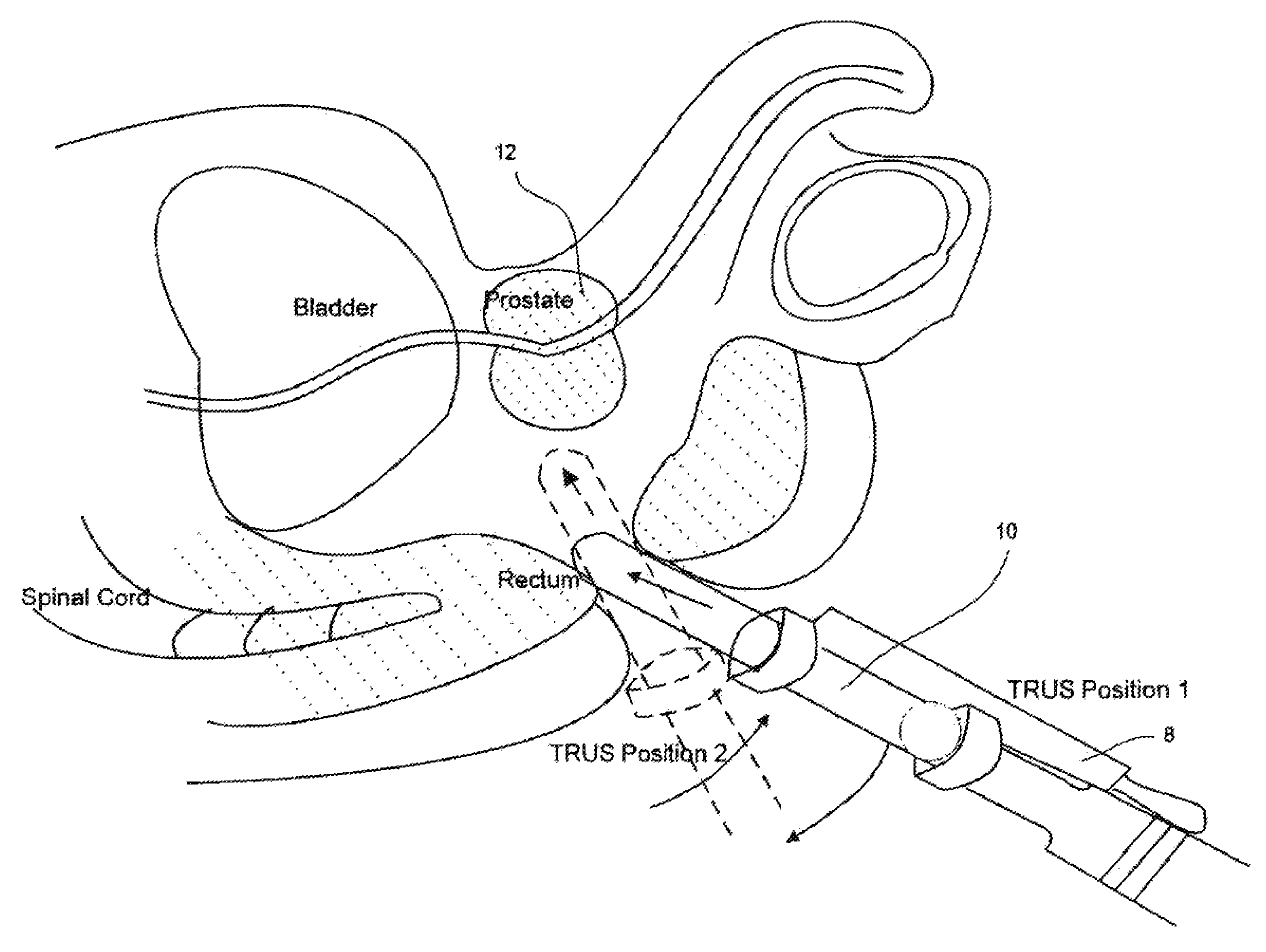 Object recognition system for medical imaging