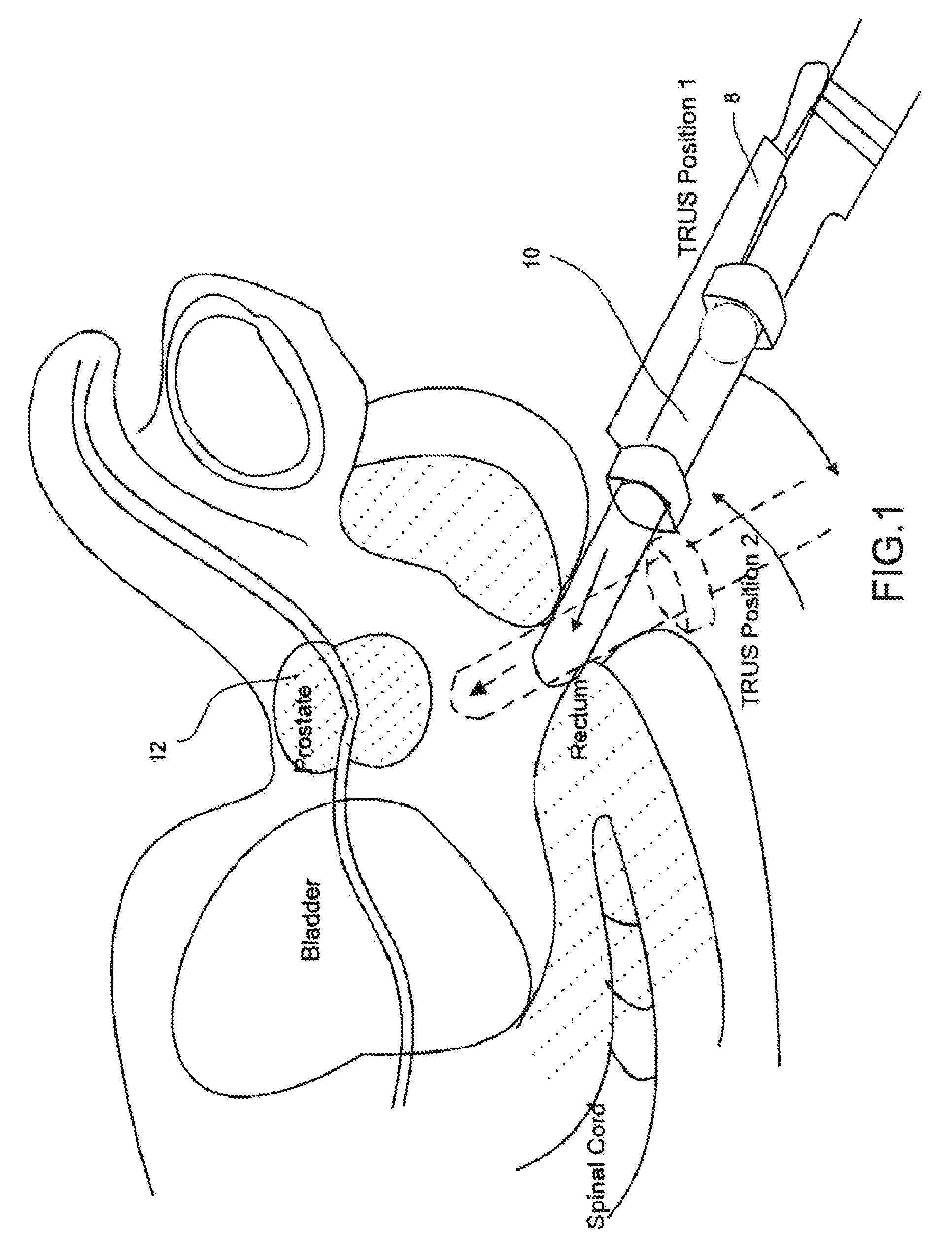 Object recognition system for medical imaging