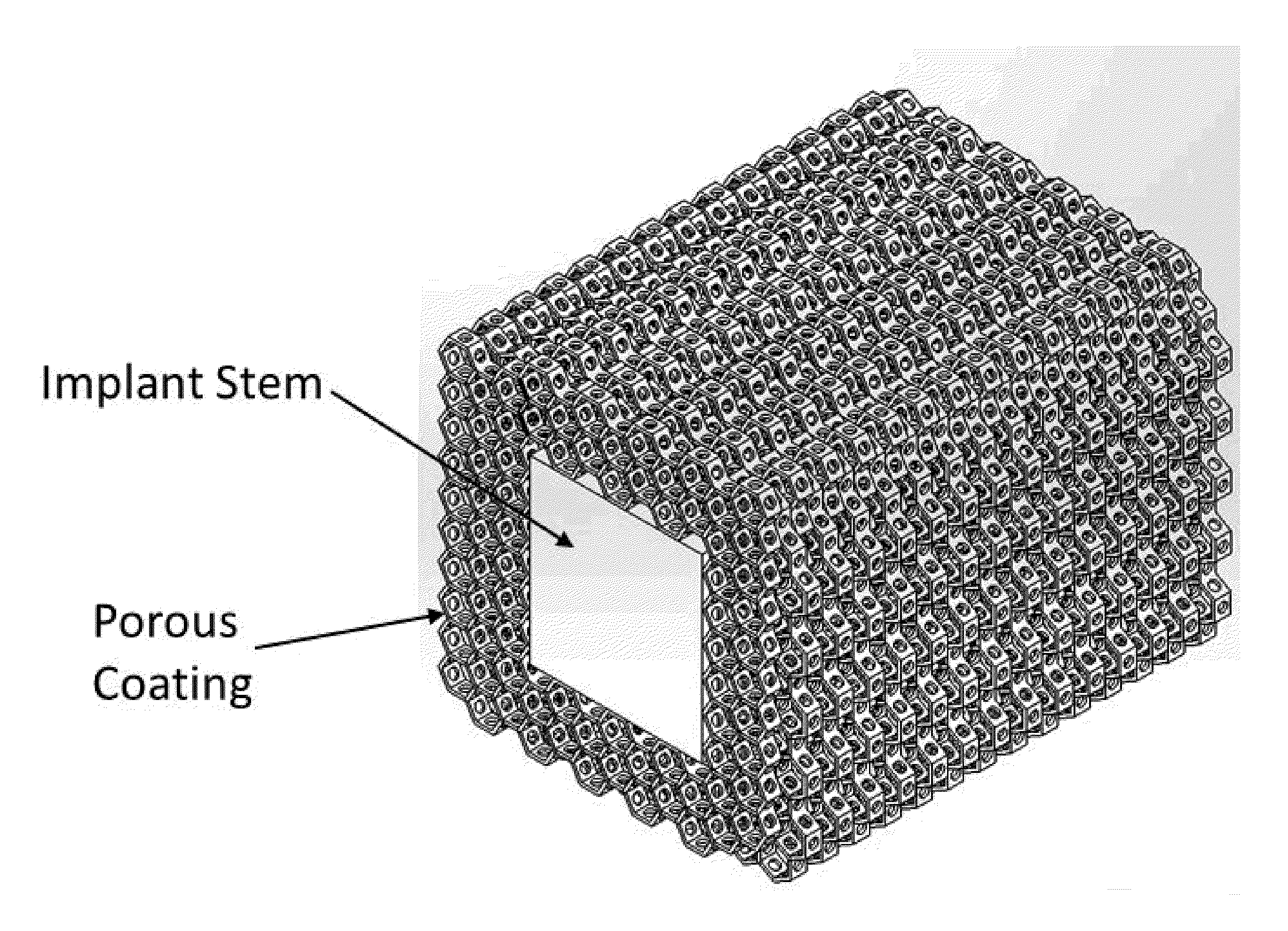 Porous coating for orthopedic implant utilizing porous, shape memory materials