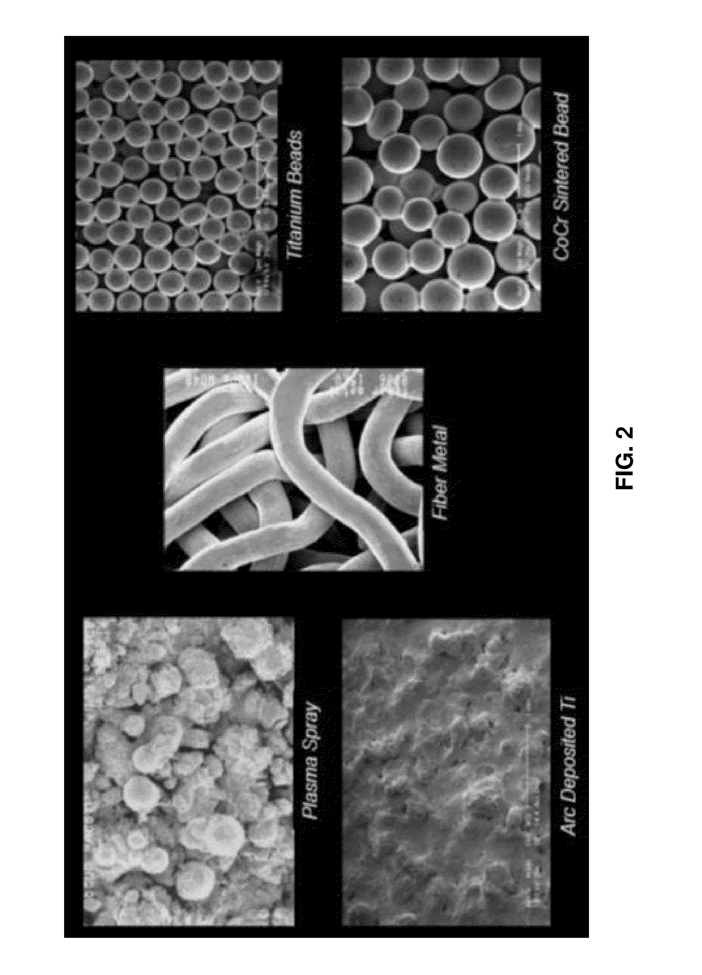 Porous coating for orthopedic implant utilizing porous, shape memory materials