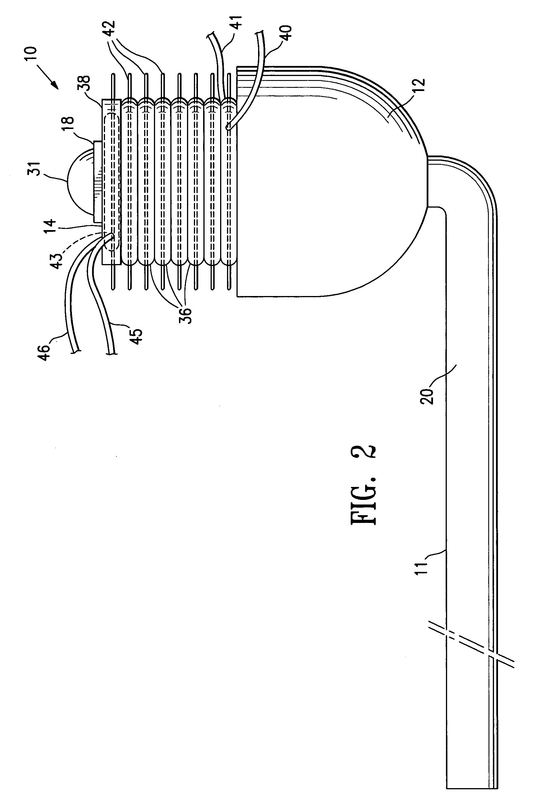 Uterine artery occlusion device with cervical receptacle