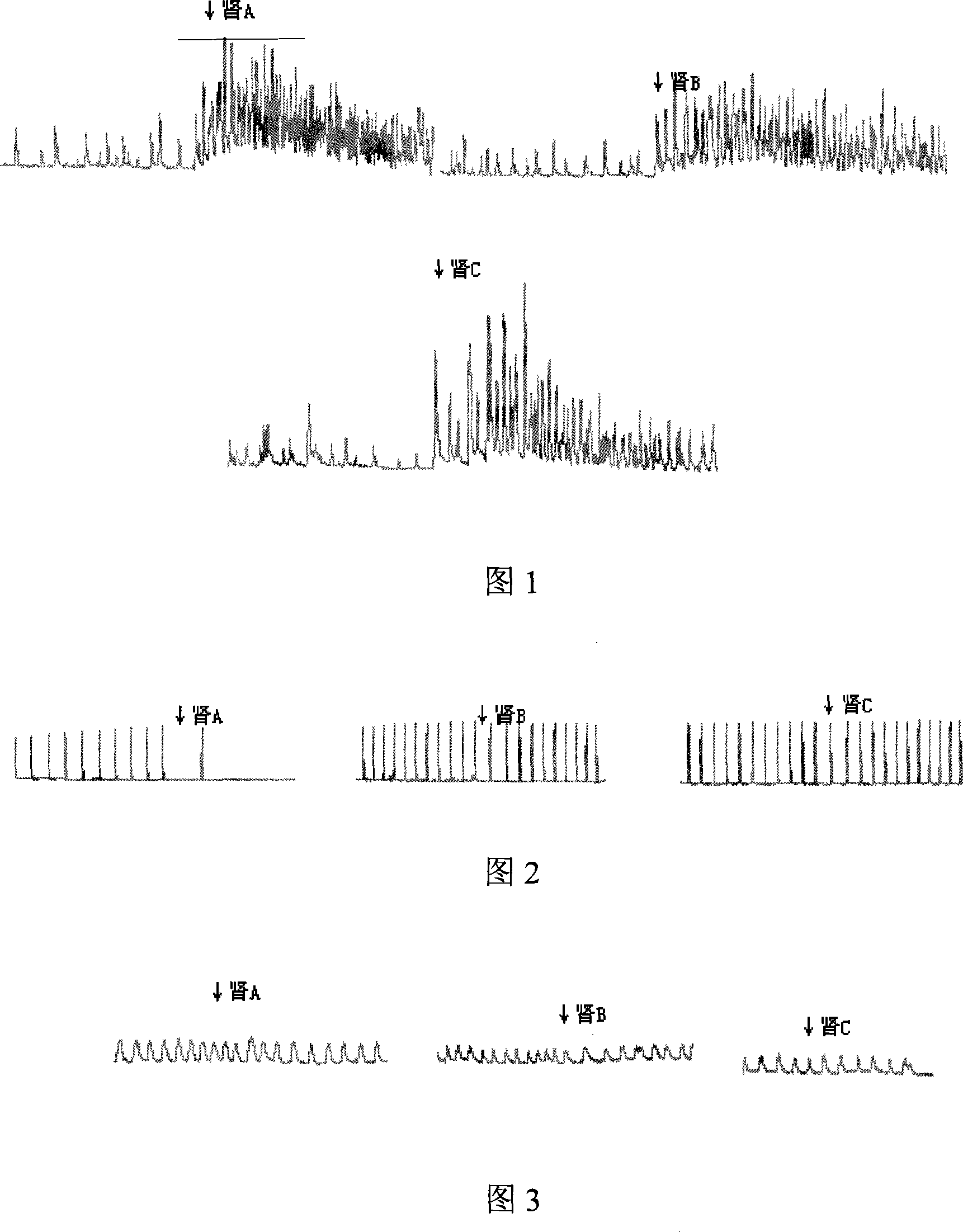 Clerodendranthus spicatus anti-urinary-stone extract and preparing method thereof