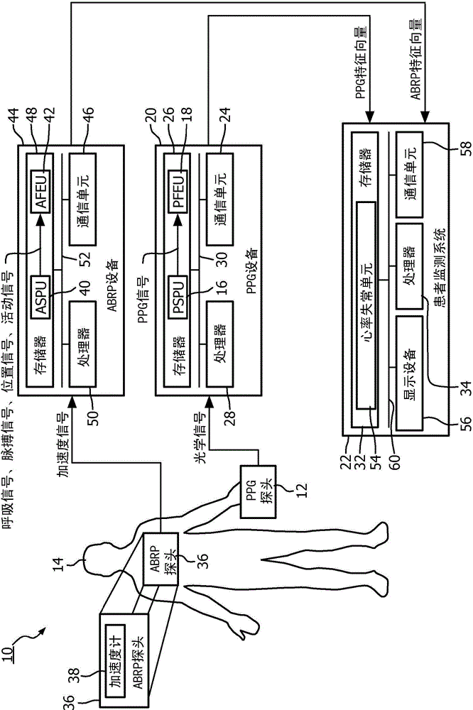 System and method to detect significant arrhythmic events through photoplethysmogram (PPG) and accelerometer