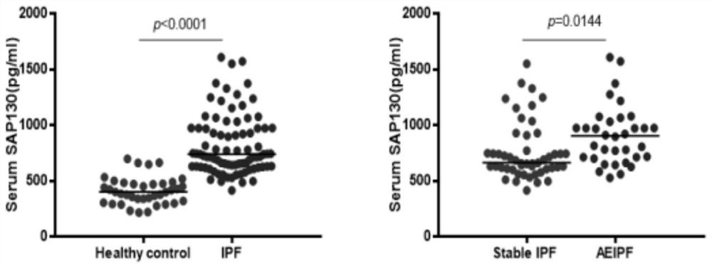 Application of splicing-associated protein 130 in diagnosis of idiopathic pulmonary interstitial fibrosis and assessment of disease severity