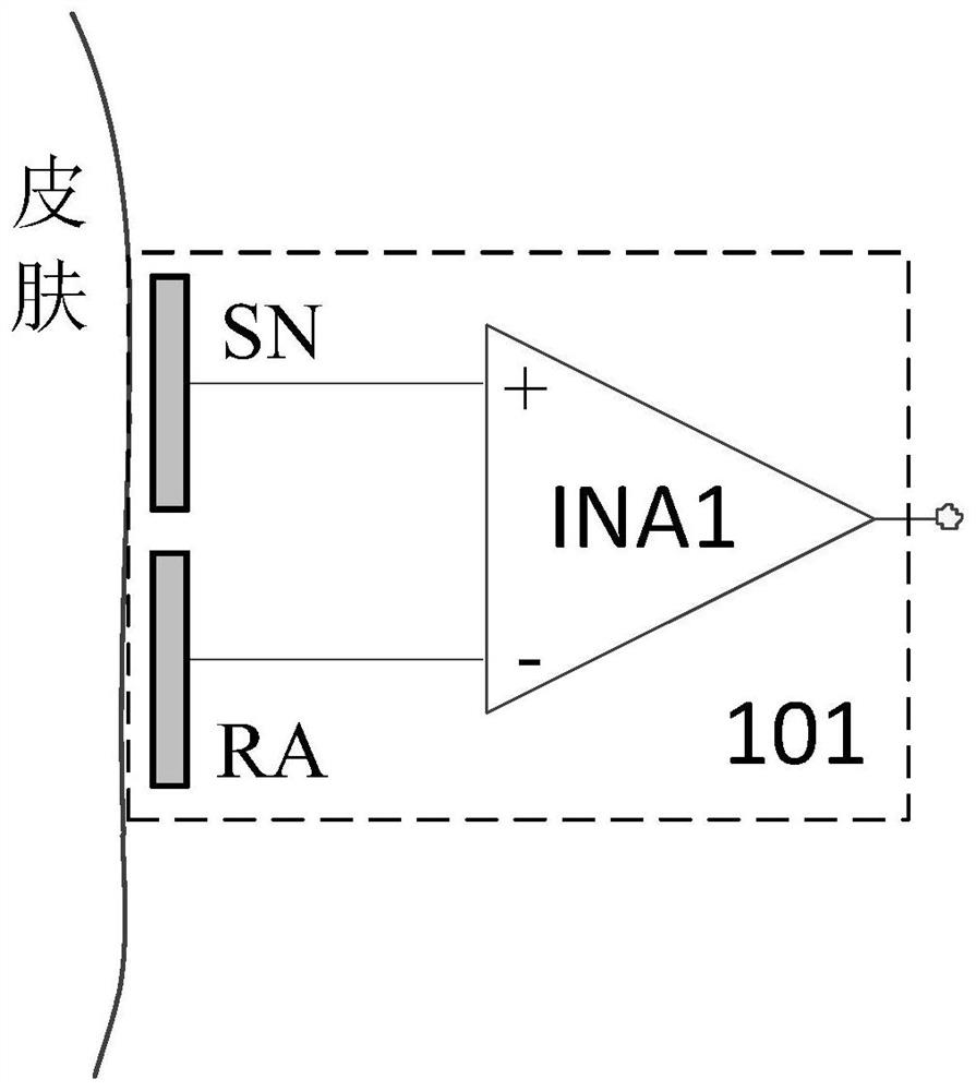 Motion artifact suppression method and twelve-lead wearable electrocardiogram monitoring equipment applying motion artifact suppression method