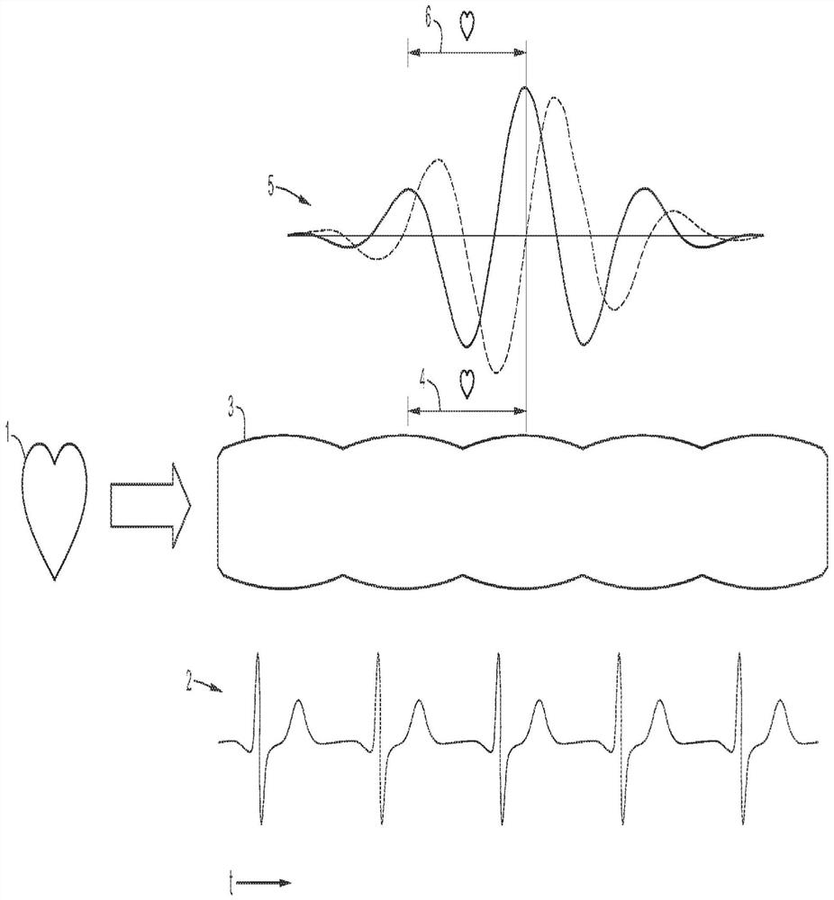 Improved methods for angiography