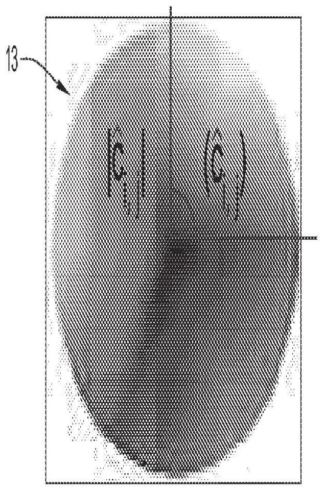 Improved methods for angiography