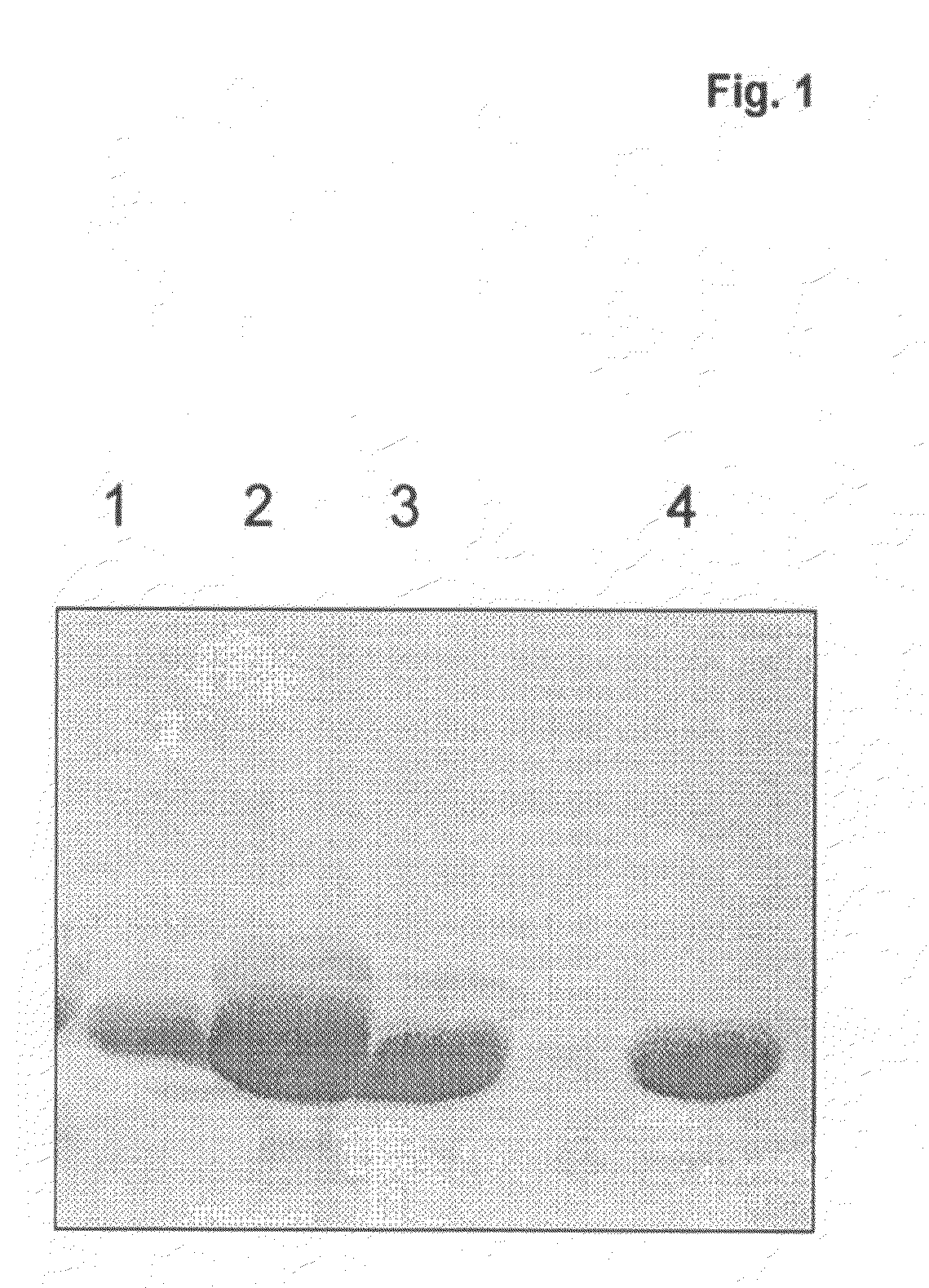 Recombinant n-glycosylated proteins from procaryotic cells